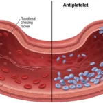 Difference Between Anticoagulant and Antiplatelet