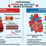 Difference Between STEMI and NSTEMI